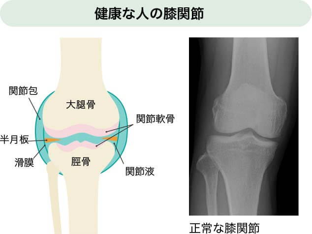 健康な人の膝関節